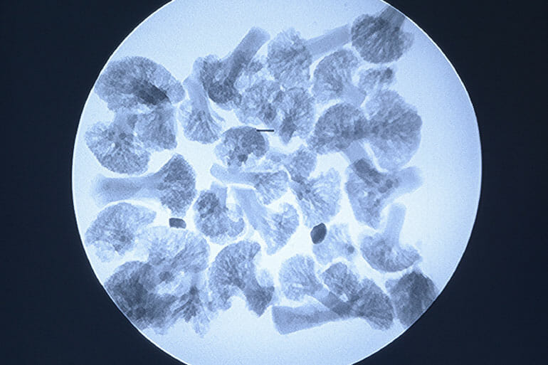 When Do Portable XRay Machine Rentals Make Sense?